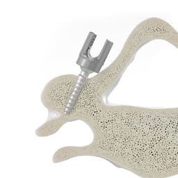 Ennovate® Cervical-Product Picture CW