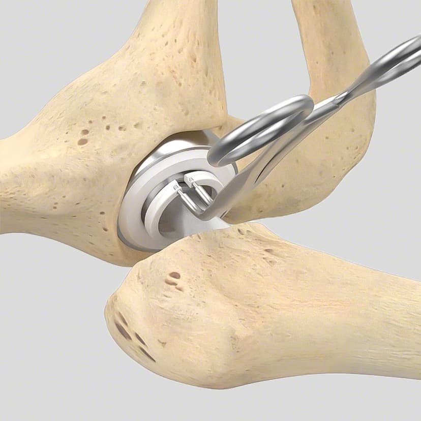 Bipolar Cup-Produktbild