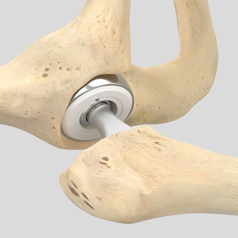 Bipolar Cup-Produktbild