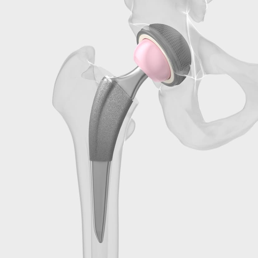 Excia® T-Product Picture